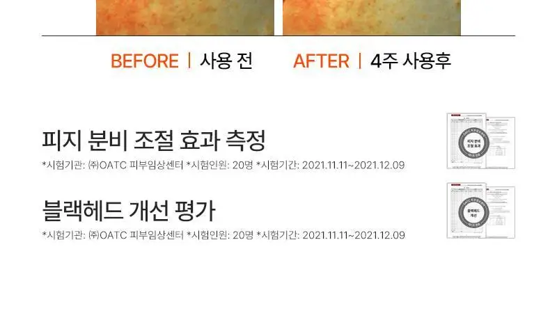 [피지/진정케어] 피캄 베리어 사이클 락토P 토너 200ml 상세페이지 19